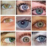 permanent laser eye color change