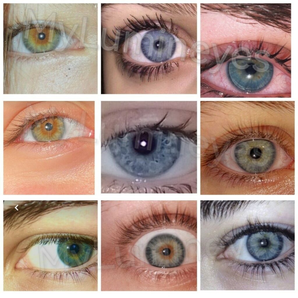 터키의 눈 색깔 변화