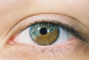 операция за промяна на цвета на очите