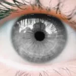 schimbarea culorii ochilor prin operație cu laser
