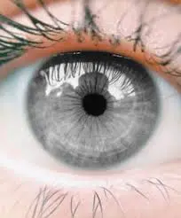 αλλάξτε το χρώμα των ματιών με χειρουργική επέμβαση λέιζερ