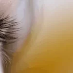 operație de schimbare a culorii ochilor cu laser
