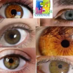 cosmetic surgery to change eye color